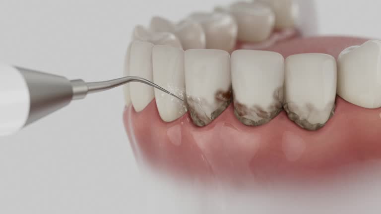 Trusted Wisdom Tooth Removal service in Abita Springs, LA - Dentist Open Now